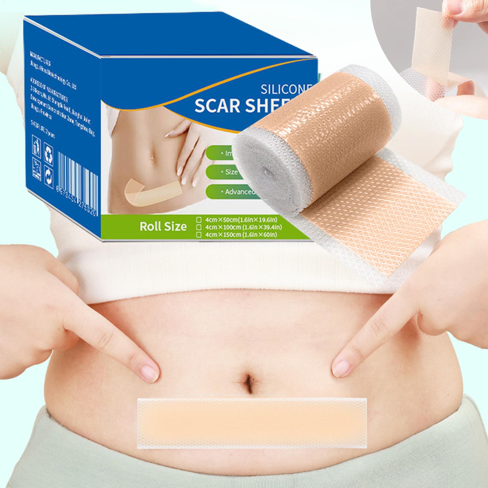 1 Roll Silicone Scar Sheets 4c - Sheet Mask Collagen 리뷰 및 가격